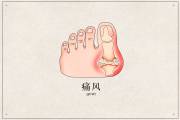 Slide-1